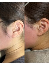 ミオワックス(MIOWAX)/もみあげの長さによる印象の違い