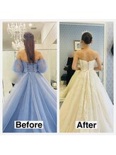 ライズ/お客様のビフォーアフター