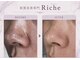 リッシュ(Riche)の写真/毛穴やニキビなどお肌のお悩みへ集中アプローチ☆ハーブピーリング/毛穴洗浄◎肌質改善と癒やしのエステ