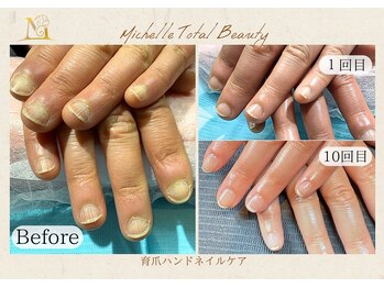 ミシェル(Michelle)の写真/パラジェル登録サロンおよびカルジェル登録サロンです。豊富なネイルチップサンプルをご用意しています♪