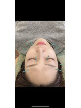 ヒーリングサロン アージュ(A-je)/★美顔鍼＋小顔矯正★