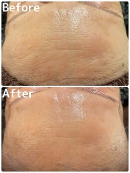 シュシュ 立川駅前(ChouChou)/一度でこの効果!!