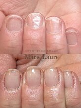 マリーロール 淀屋橋本店(Marie Laure)/自爪育成/深爪矯正/ネイルケア