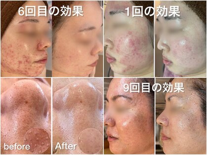 エヌエースキン 武蔵小杉店(Naskin)の写真