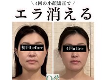 キュープ 広島店(Qpu)の雰囲気（そのエラ張り、実は骨格のせいじゃないかも？!）