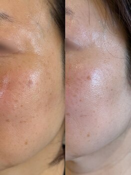 ベル(Belle)/トーンUP