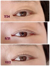 ビューティサロン ベル(bell)/エグータムの効果