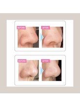 レアハレ(LeaHale)/『毛穴ケア』