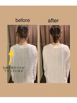 アイリー(Irie)/骨格矯正