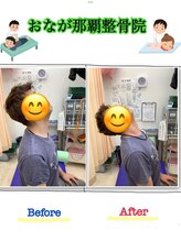 おなが浦添当山整体院/頚の痛み改善！可動域アップ！