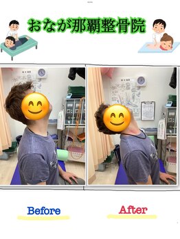 おなが浦添当山整骨院/頚の痛み改善!可動域アップ!