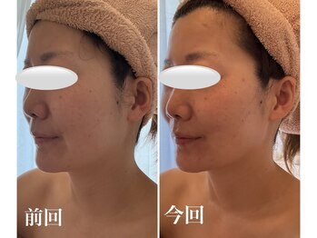 美バストアルファ(美bust α)/【小顔コルギ&バストアップ】