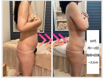 ヴィオラ(Viola)/人気NO.1 痩身コース