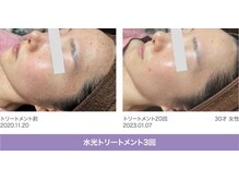 ジャミングレブ 六本木(jammmingrev)の雰囲気（六本木/水光ピーリング/ララピール/ヘアセット/韓国肌管理）