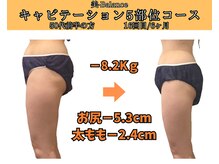 ビーバランス 本町店(美-Balance)/50代前半　月5部位コース