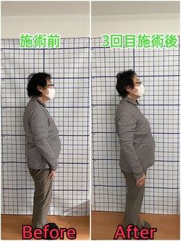 幸鍼灸整体院 武庫之荘院/整体・トレーニング・姿勢変化6