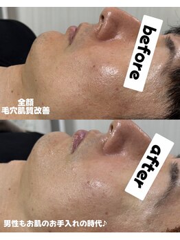 シロ(SHIRO)/男性もエステに通う時代