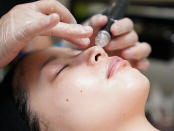 パチュプチ(Patchou petit)の写真/本気の肌ケア★ハイドラフェイシャルで奥底の毛穴汚れを徹底洗浄!!毛穴レスなツルツルすっぴん美肌に♪