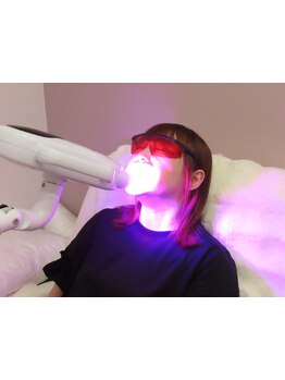 美白ケアをしたい