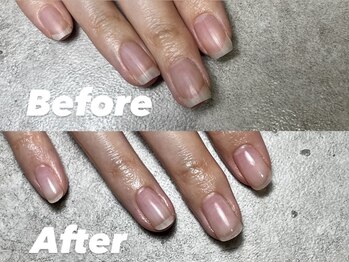 結(Yui)/自爪育成 Before→After