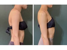 ストレートネック改善、肩こり、猫背、姿勢矯正。疲労解消にも！