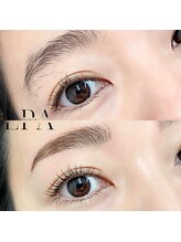 レピア 郡山駅前店/韓国式LEPIA Before&After