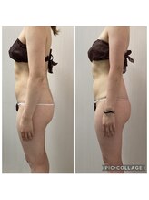 BBC 田園調布/お腹の施術