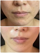 ミロク(369)/乾燥肌＆荒れやすい肌を丈夫に