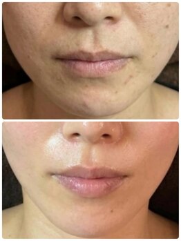 ミロク(369)/乾燥肌&荒れやすい肌を丈夫に