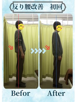 アミーゴ整体院/ビフォーアフター