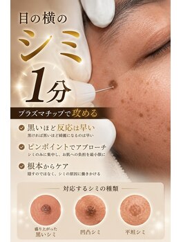 フルール(Fleur.)の写真/40代からの頑固なシミ＆シワに◎那覇初導入【韓国発プラズマ×臍帯血成分】年齢肌をケア。那覇市おもろまち