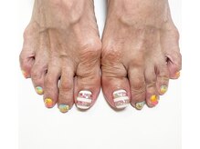 アイリッシュネイル 久屋大通店(Irish Nail)/サマーフラワー　フット