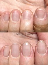 マリーロール 梅田店(Marie Laure)/自爪育成/深爪矯正/ネイルケア