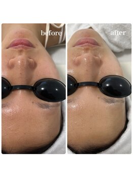 リアム(LiAm)/ツヤ肌 &nbsp;ララピール