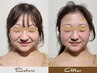 ≪満足度95％超/本気の小顔革命≫美容頭蓋小顔矯正90分￥13000→