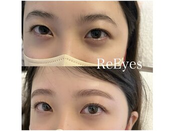 リアイズ(ReEyes)