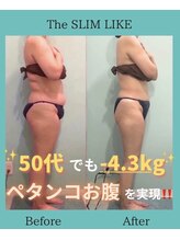 スリムライク 鳥取店(The SLIM LIKE)/痩身ビフォーアフター
