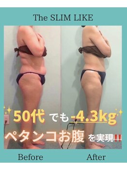スリムライク 鳥取店(The SLIM LIKE)/痩身ビフォーアフター