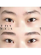 レピア 郡山駅前店/韓国式LEPIA Before&After