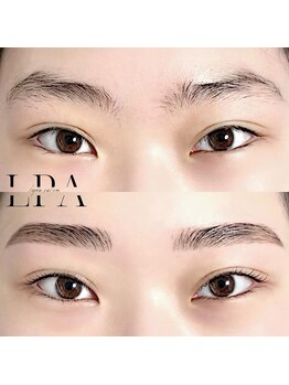 レピア 郡山駅前店/韓国式LEPIA Before&After