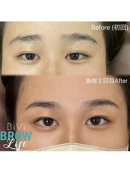 ビビ 東海店(BiVi)/左右差を整えます☆