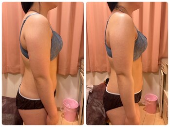 レイビス 仙台店(RAYVIS)/姿勢改善1