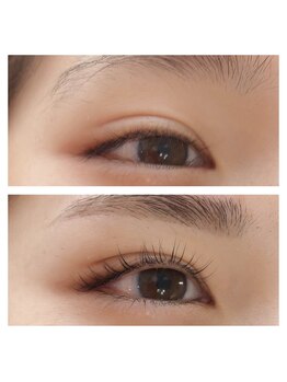 ラフィーネ(Raffine)/美眉＆アッパーリフトカール