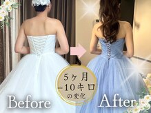 スリムプロ 天王寺店(Slimpro)/ブライダルエステ☆
