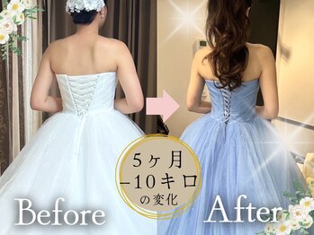 スリムプロ 天王寺店(Slimpro)/ブライダルエステ☆
