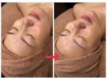 ナチュラックスビューティー 恵比寿店(NaturaxBeauty)/お肌を育てるララピール