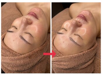 ナチュラックスビューティー 恵比寿店(NaturaxBeauty)/お肌を育てるララピール