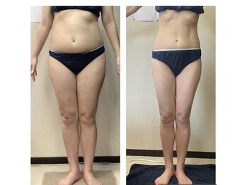 美ボディラボ(美Body Labo)/ご来店お待ちしております♪