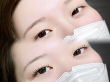 ロピ 江坂(LOPI)/&Healthy(アンドヘルシー)100本