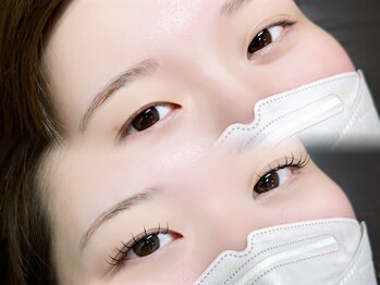 ロピ 江坂(LOPI)/&Healthy(アンドヘルシー)100本